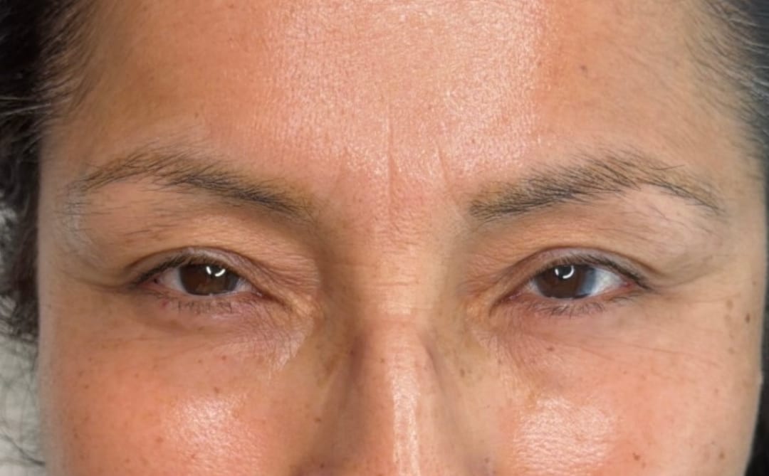 Antes de la micropigmentación de cejas pelo a pelo